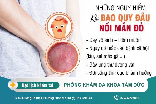 Vì sao quy đầu nổi mẩn đỏ không ngứa? Phương pháp điều trị như thế nào?