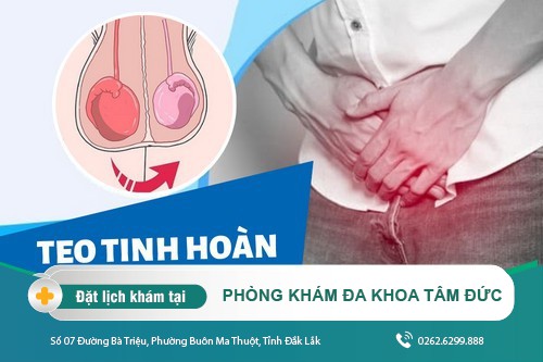 Teo tinh hoàn: Bệnh lý nguy hiểm và địa chỉ chữa trị uy tín chất lượng tại đây