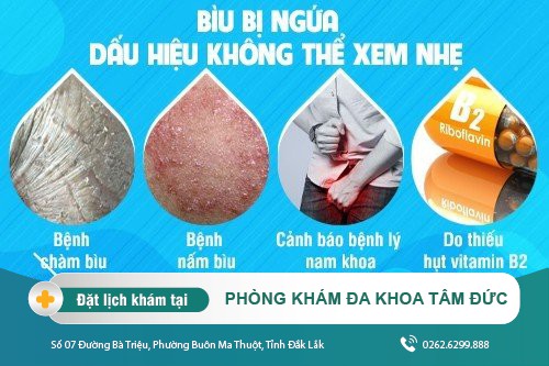 Bìu bị ngứa là hiện tượng bệnh lý gì ở nam giới có gây nguy hiểm?