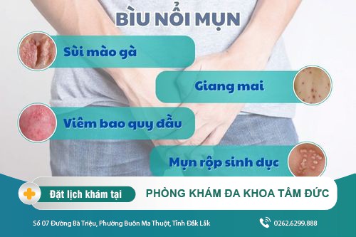 Chữa mụn vùng kín tại Đắk lắk - Bị nổi mụn ở vùng kín nam là bệnh gì?