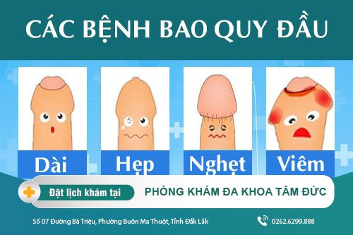 Các bệnh về bao quy đầu ở nam giới