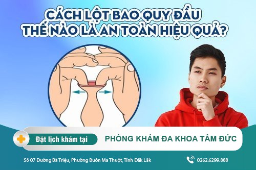 Khi nào cần lột bao quy đầu? Cách lột bao quy đầu an toàn