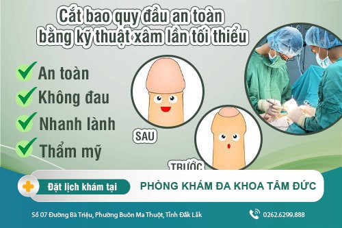 Chữa viêm bao quy đầu công nghệ cao tại Nam Khoa Tâm Việt