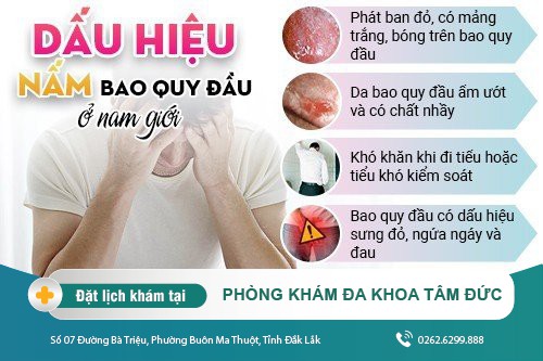 Nấm bao quy đầu - Nguyên nhân, dấu hiệu và cách điều trị hiệu quả