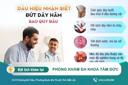 Đứt dây hãm bao quy đầu và cách xử lý khi gặp phải phái nam nên xem ngay