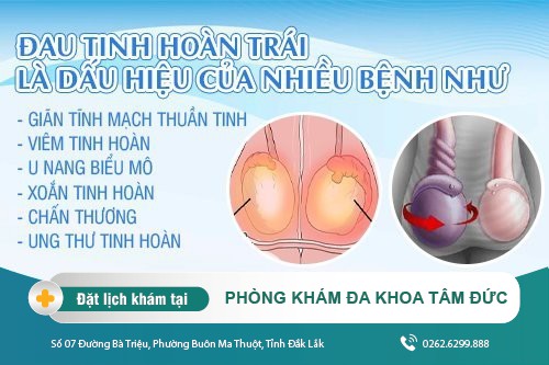 Đau tinh hoàn trái là dấu hiệu của bệnh gì?