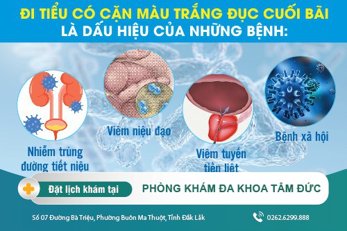 Đi tiểu có cặn màu trắng đục cuối bãi là dấu hiệu bệnh gì? Có nguy hiểm không?