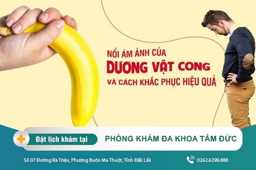 Nổi ám ảnh của dương vật cong và cách khắc phục hiệu quả