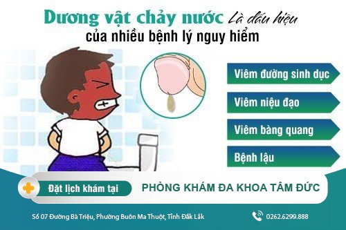 Dương vật chảy nước - dấu hiệu bất thường ở dương vật