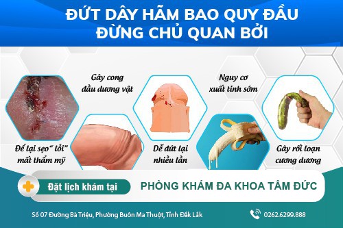 Chi phí nối dây hãm bao quy đầu là bao nhiêu?