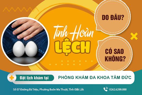 Tinh hoàn bị lệch ở nam giới thường do nguyên nhân gì gây ra? Cách khắc phục ra sao?