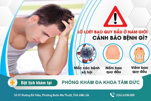Lở loét bao quy đầu ở nam giới - tác hại và cách điều trị hiệu quả