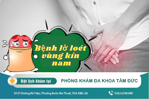 Các nguyên nhân lở loét vùng kín ở nam giới và biện pháp khắc phục
