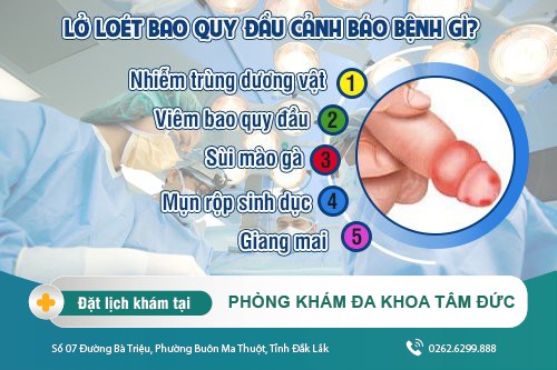 Lở loét bao quy đầu và những điều cần lưu ý