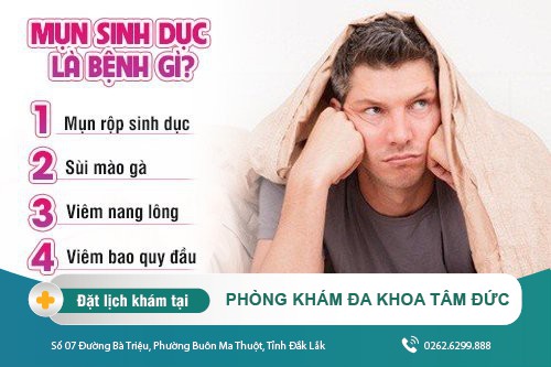Không nên chủ quan với bệnh mụn sinh dục