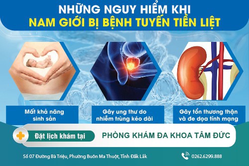 Mổ tiền liệt tuyến ở đâu? Chi phí mổ tuyến tiền liệt bao nhiêu?