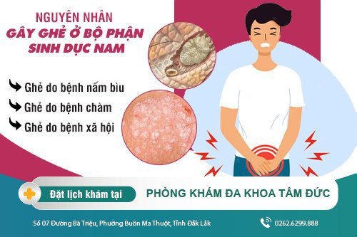 Ghẻ dương vật và cách điều trị hiệu quả