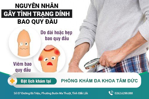 Dính bao quy đầu do đâu và cách xử lý ra sao phái mạnh tham khảo ngay