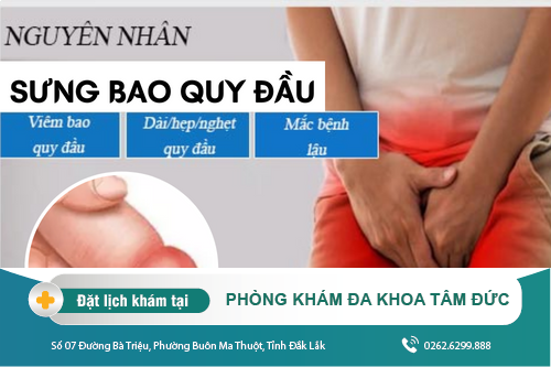 Sưng bao quy đầu do đâu và trị bằng cách nào