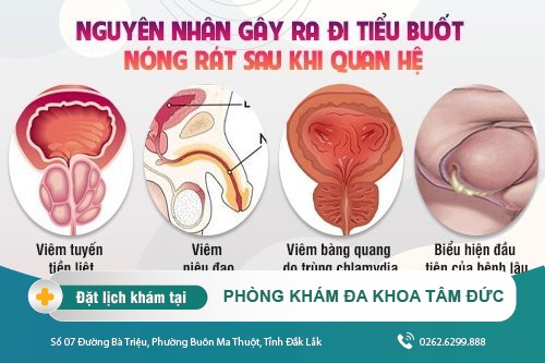 Nguyên nhân gây ra chứng tiểu buốt, nóng rát sau quan hệ