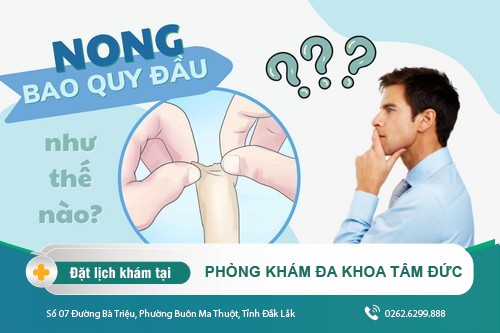 Có nên tự nong bao quy đầu tại nhà? Cách nong bao quy đầu như thế nào?