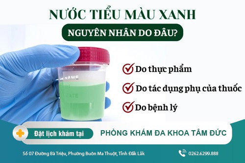 Cách trị viêm đường tiểu tại Đắk Lắk - Nước tiểu màu xanh có sao không?