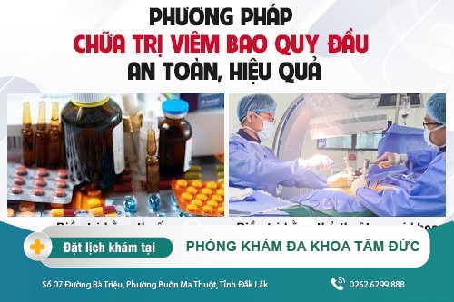 Chữa viêm bao quy đầu thế nào mới hiệu quả?