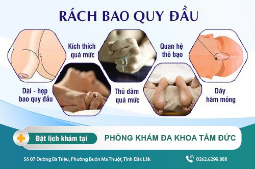 Rách bao quy đầu và những điều liên quan tiềm ẩn bệnh lý nguy hiểm