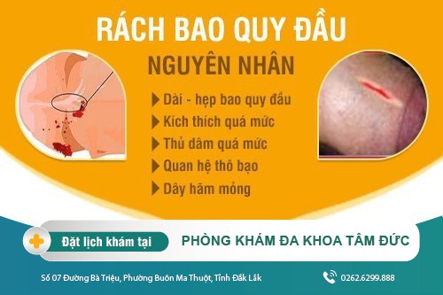 Tình trạng rách bao quy đầu ở nam giới - Nguyên nhân và cách khắc phục