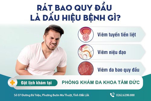 Bao quy đầu đau rát là dấu hiệu của bệnh lý gì?