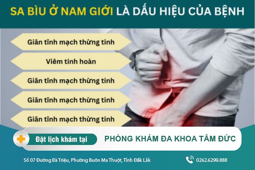 Bệnh sa bìu ở nam giới và những mức độ mà nam giới nên tìm hiểu