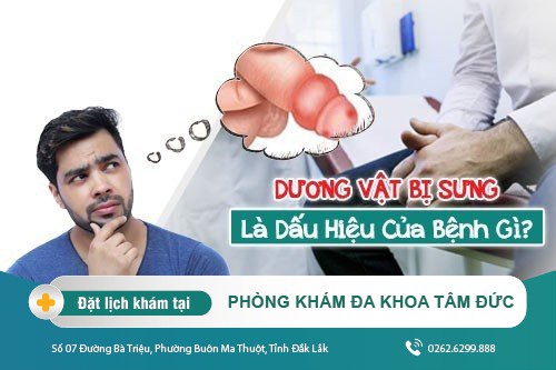 Vì sao bị sưng dương vật? Phương pháp chữa sưng dương vật hiệu quả