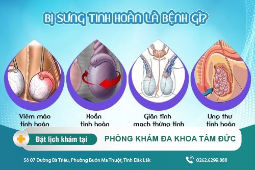 SƯNG TINH HOÀN LÀ DẤU HIỆU CỦA BỆNH GÌ VÀ CHỮA BẰNG CÁCH NÀO?