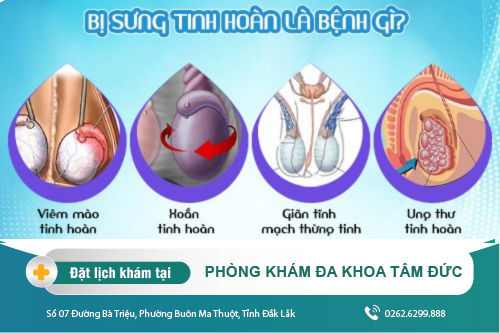 Bị sưng tinh hoàn: Nguyên nhân và cách khắc phục hiện nay