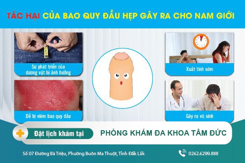 Bao quy đầu hẹp có ảnh hưởng gì không? Điều trị như thế nào?