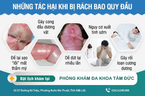 Nam giới bị rách bao quy đầu và cách khắc phục hiện nay