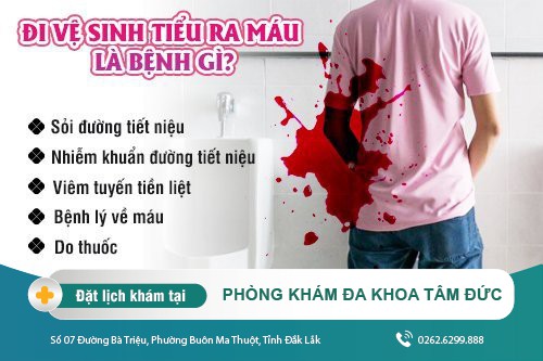 Cách chữa tiểu ra máu tại Đắk lắk - Đi vệ sinh ra máu có nguy hiểm không?