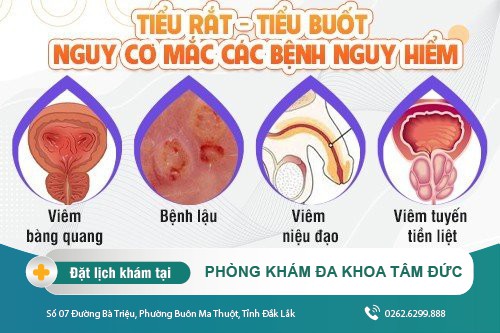 Dấu hiệu nguy hiểm của hiện tượng đi tiểu buốt
