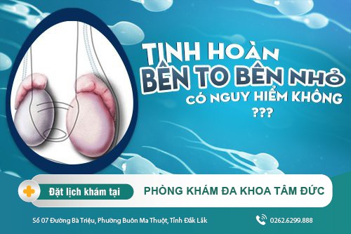Tinh hoàn một bên to, một bên nhỏ nguyên nhân do đâu? Cách khắc phục