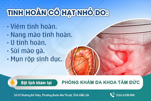 Tinh hoàn nổi hạt do đâu gây ra - Tìm hiểu cách khắc phục ngay