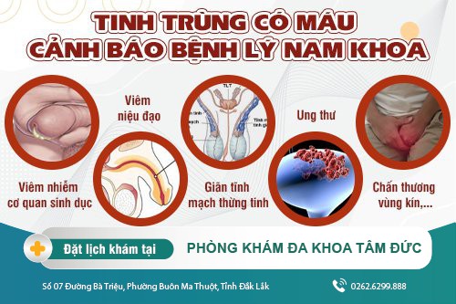 Tinh trùng có máu - Dấu hiệu của nhiều bệnh nam khoa nguy hiểm