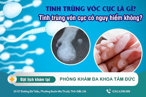 Tinh trùng vón cục - chẩn đoán bệnh lý qua hiện tượng tinh trùng