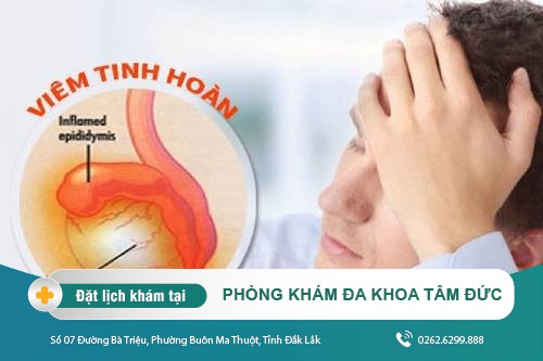 Những điều cần biết về viêm tinh hoàn