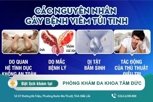 Viêm túi tinh ở phái nam và những điều cần biết khi mắc phái